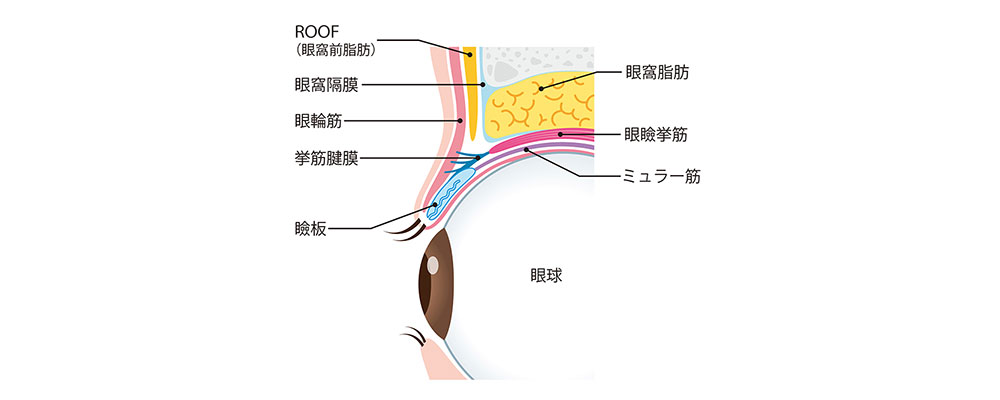 当院では２つの埋没法を行っております