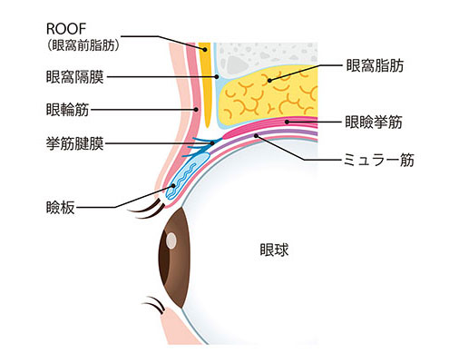 当院では２つの埋没法を行っております